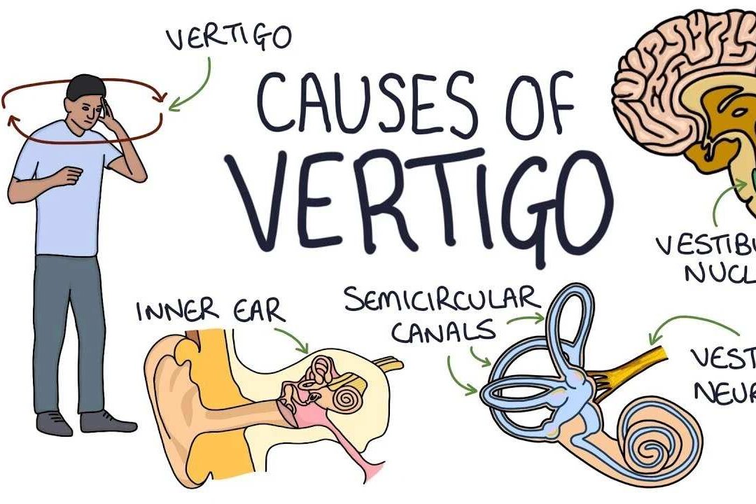 What Are The Symptoms Of Vertigo: