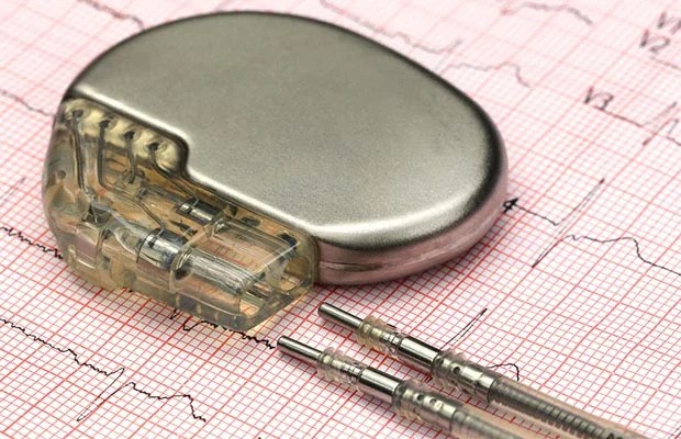 How Do Pacemakers Work: